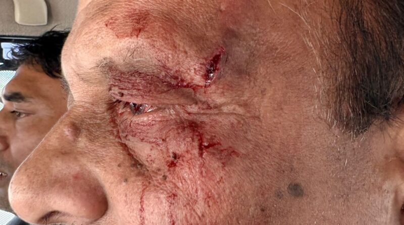 उत्तराखंड शिक्षा निदेशक पर मारपीट के आरोप, अस्पताल में भर्ती